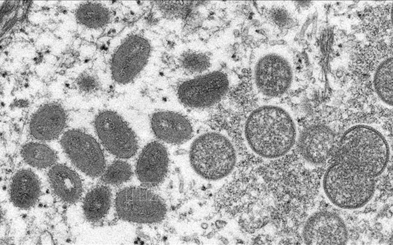 Hình ảnh virus đậu mùa khỉ dưới kính hiển vi điện tử. 