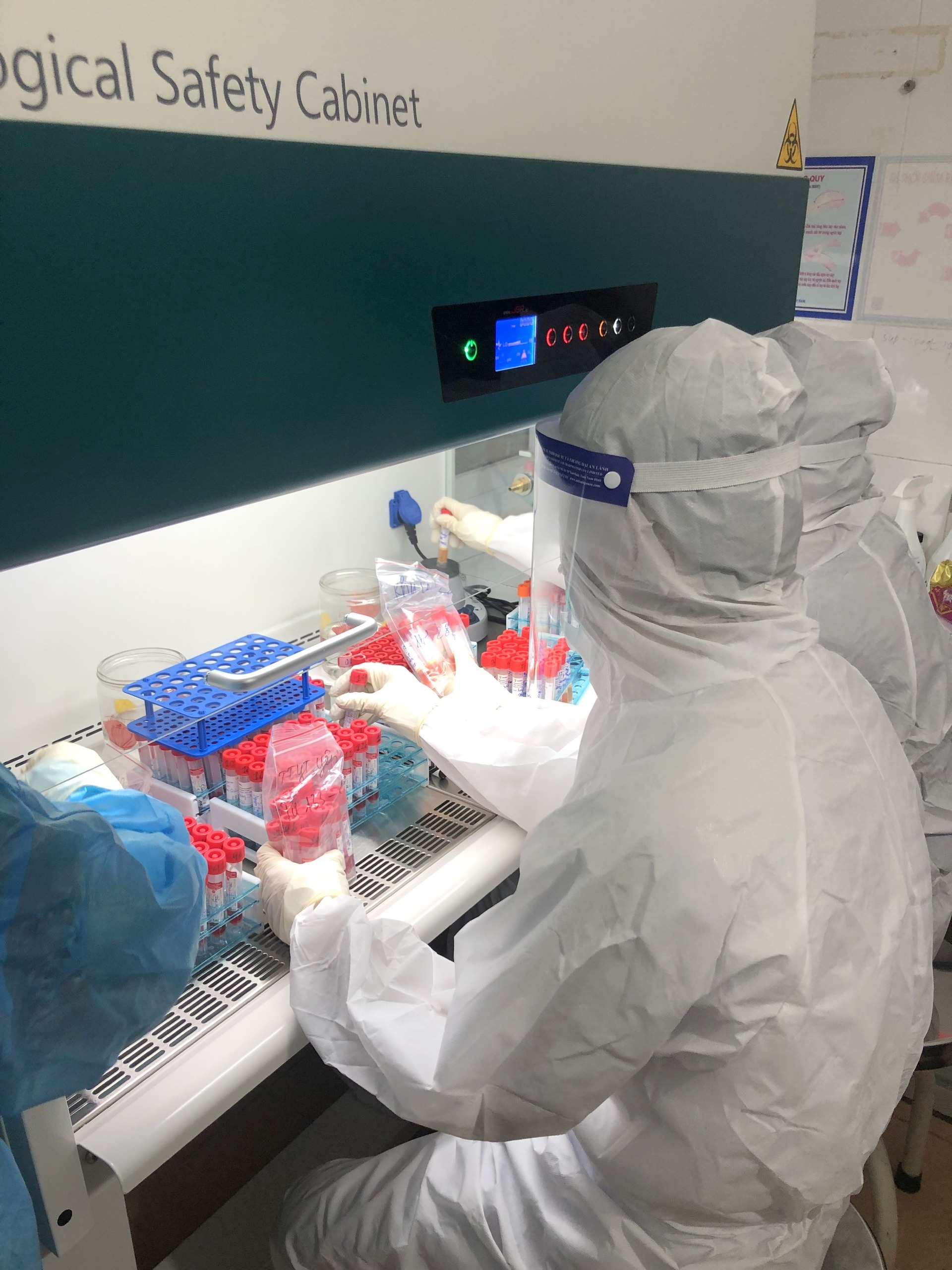 Xét nghiệm sàng lọc SARS – CoV – 2 tại Bệnh viện Đa Khoa Khu vực Yên Minh.