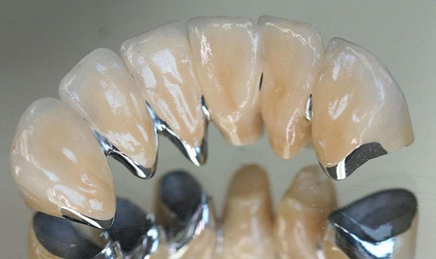 Răng sứ giá rẻ thường thuộc dòng sứ kim loại